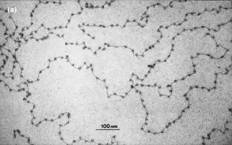 electron microscope-derived image of DNA bound up with nucleosomes