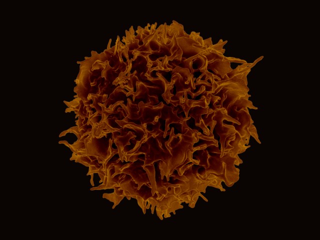 Colorized scanning electron micrograph of a T lymphocyte