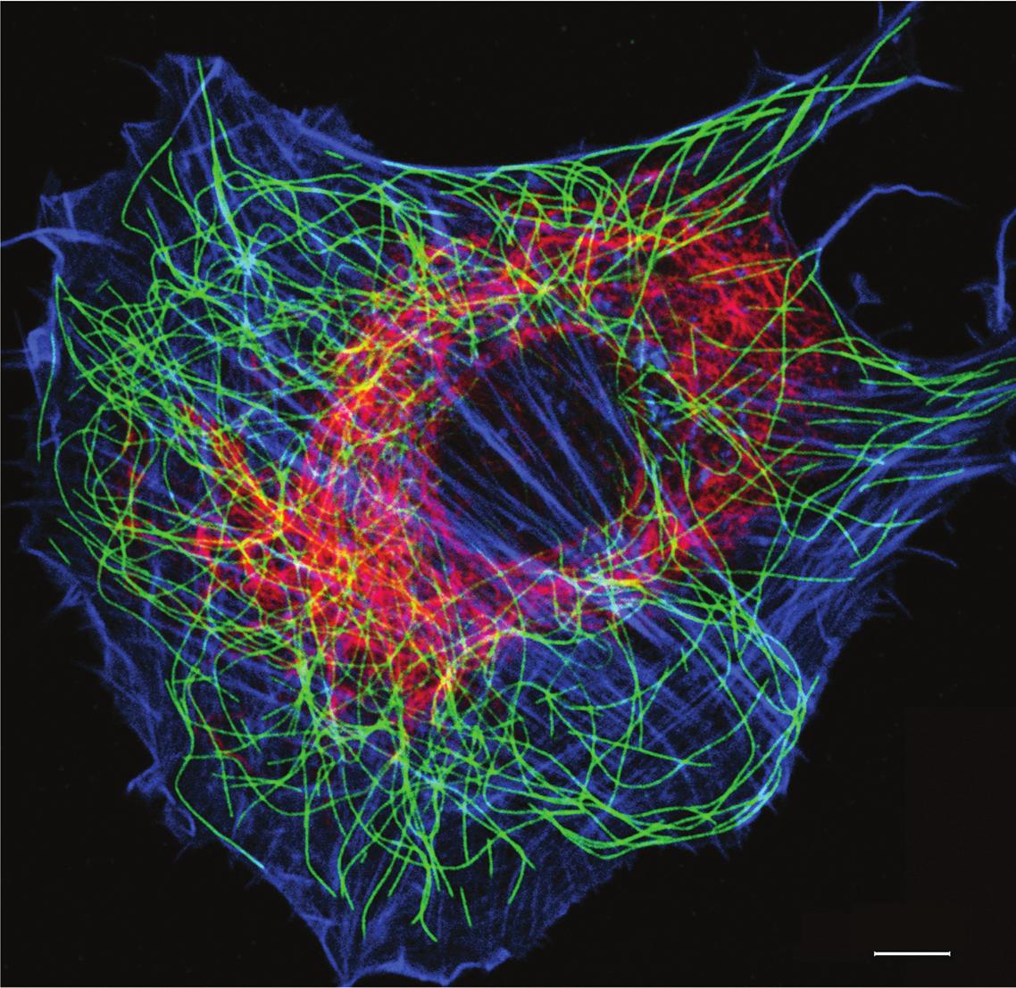 cytoskeleton of a fibroblast cell