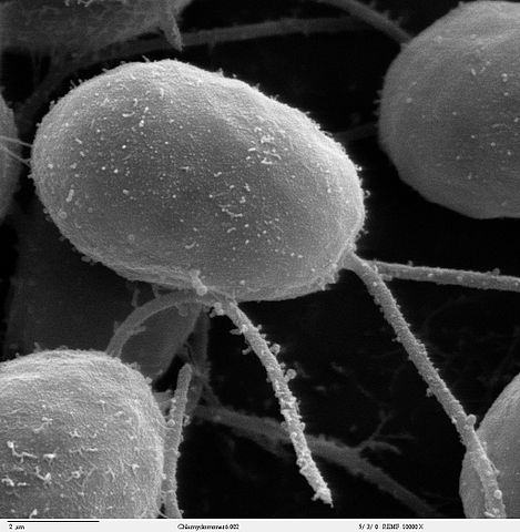 Chlamydomonas
cells with flagella